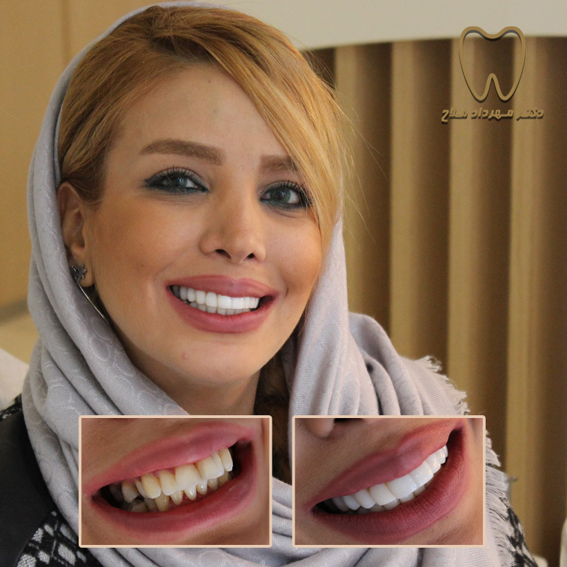 قیمت امالگاماتور دندانپزشکی