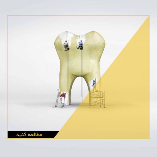 جرمگیری دندان