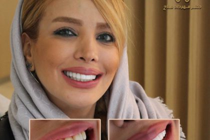 Sort-teeth-home