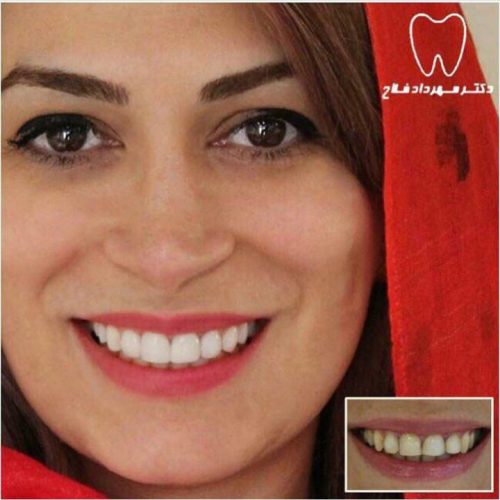 عکس های چهره و لبخند