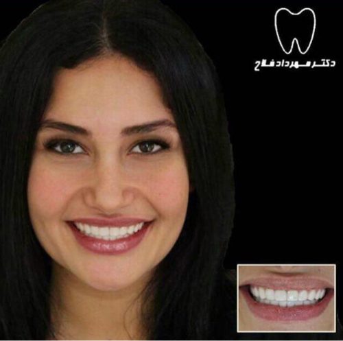 عکس های چهره و لبخند