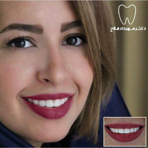عکس های چهره و لبخند