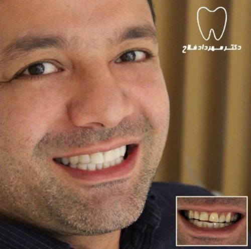 عکس های چهره و لبخند
