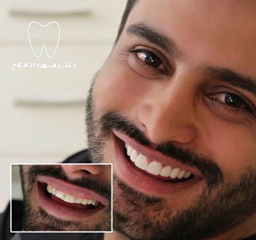 عکس های چهره و لبخند