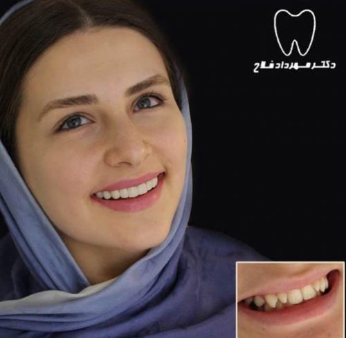 عکس های چهره و لبخند