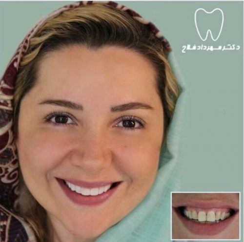 عکس های چهره و لبخند