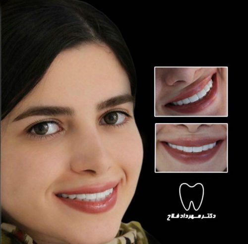 عکس های چهره و لبخند