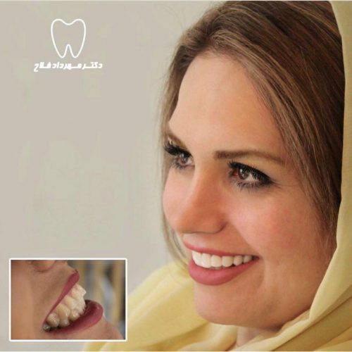 عکس های چهره و لبخند
