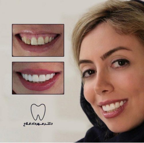 عکس های چهره و لبخند