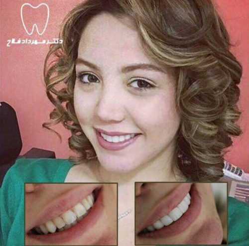 عکس های چهره و لبخند