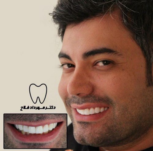عکس های چهره و لبخند