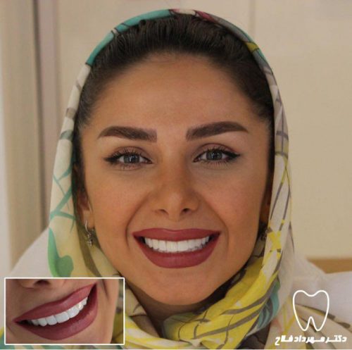 عکس های چهره و لبخند