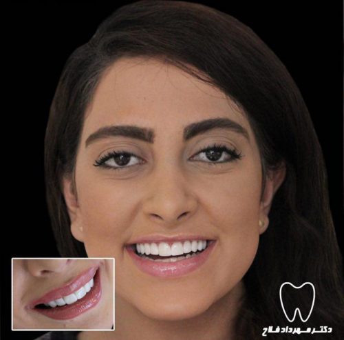 عکس های چهره و لبخند