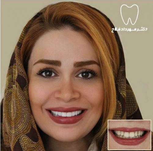 عکس های چهره و لبخند