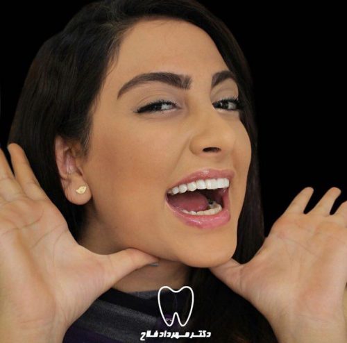 عکس های چهره و لبخند