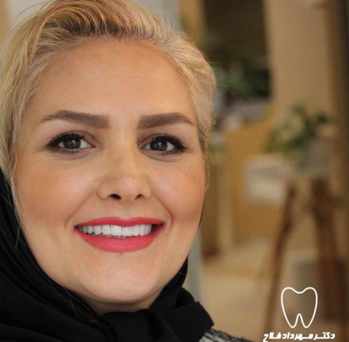 عکس های چهره و لبخند