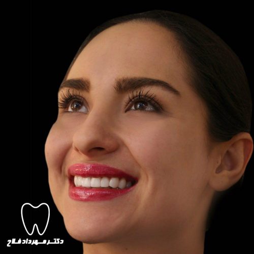 عکس های چهره و لبخند