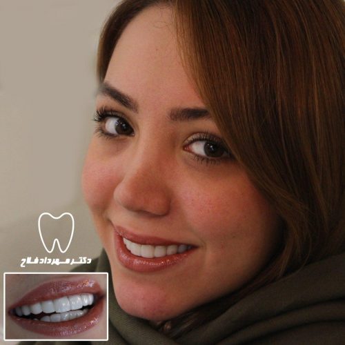 عکس های چهره و لبخند