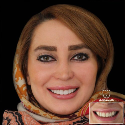 عکس های چهره و لبخند