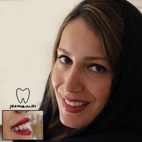 عکس های چهره و لبخند