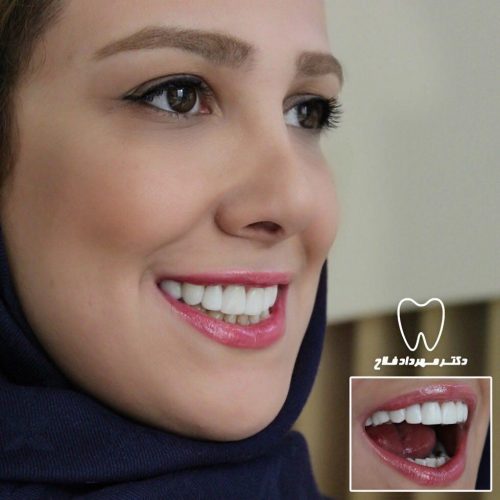 عکس های چهره و لبخند
