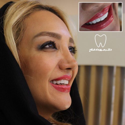 عکس های چهره و لبخند