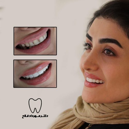 عکس های چهره و لبخند