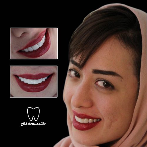 عکس های چهره و لبخند