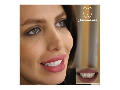 عکس های چهره و لبخند