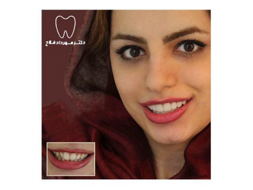 عکس های چهره و لبخند