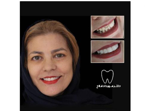 عکس های چهره و لبخند