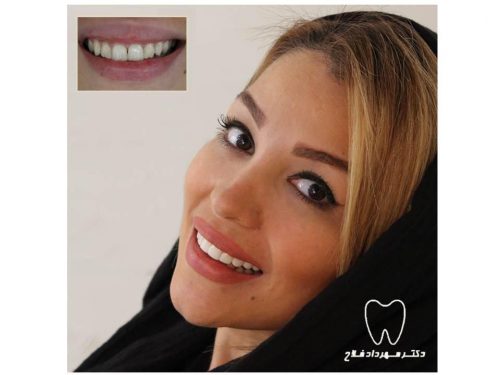 عکس های چهره و لبخند