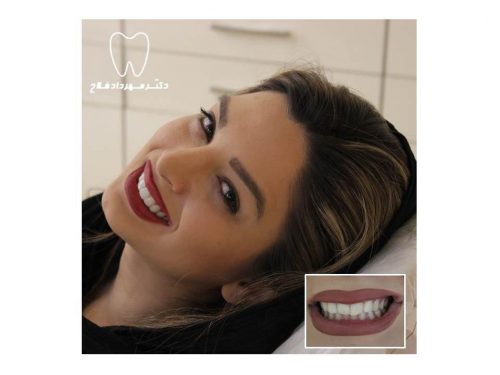 عکس های چهره و لبخند
