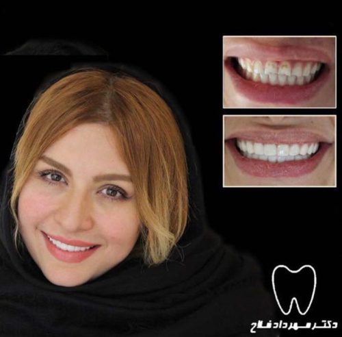 عکس های چهره و لبخند