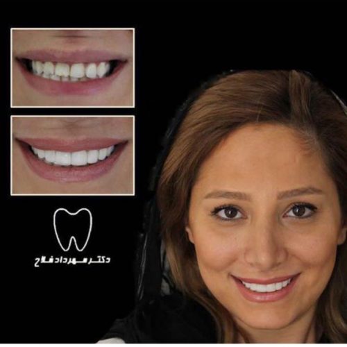 عکس های چهره و لبخند