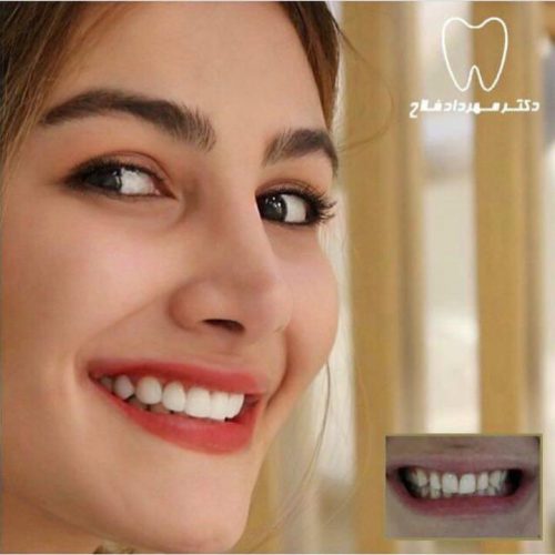 عکس های چهره و لبخند