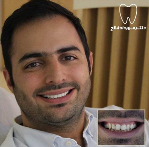 عکس های چهره و لبخند