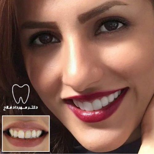 عکس های چهره و لبخند