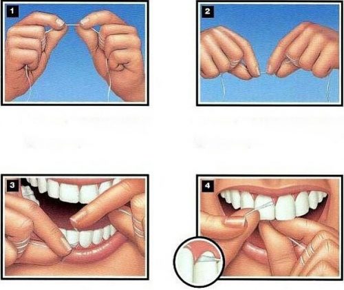 نحوه کشیدن نخ دندان تصویری