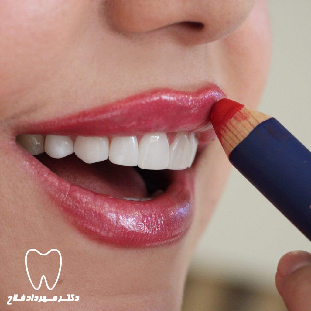 اصلاح طرح لبخند