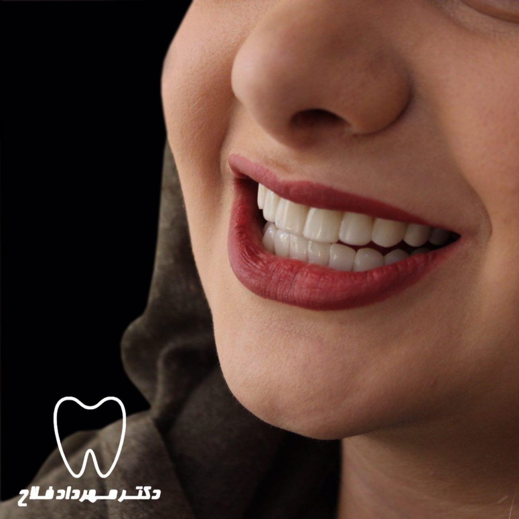 عکس های اصلاح طرح لبخند