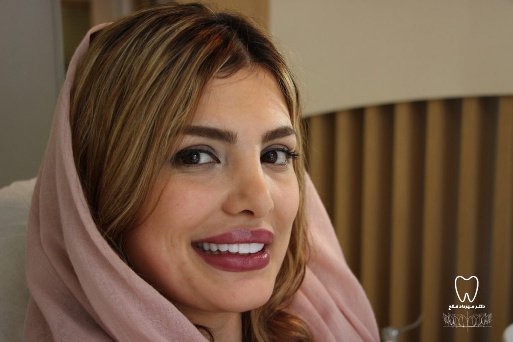 لبخند زیبا