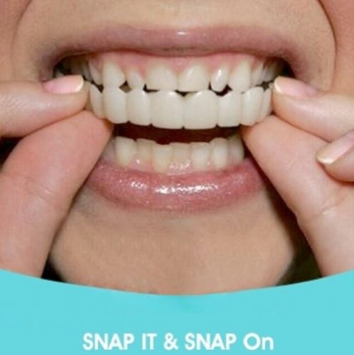 اسنپ دندان