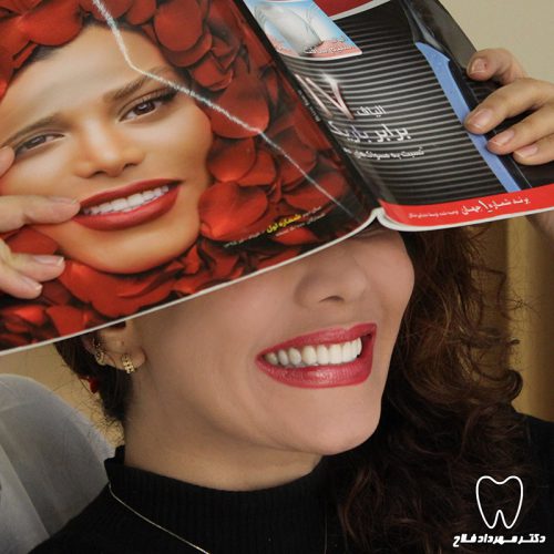 گالری عکس کامپوزیت دندان
