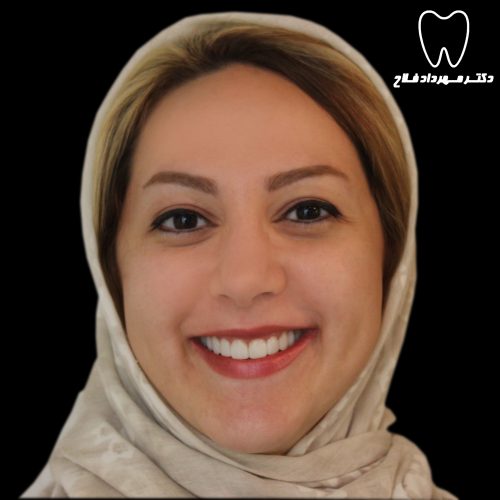 گالری عکس کامپوزیت دندان