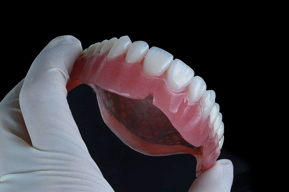 کاشت ست کامل دندان مصنوعی با پایه ایمپلنت2