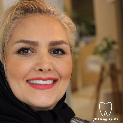 گالری عکس لامینیت
