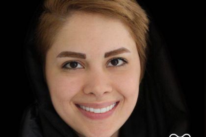 مراحل لمینت دندان مراحل لمینت دندان