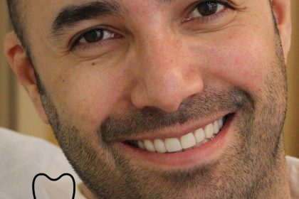 چگونگی اصلاح طرح لبخند چگونگی اصلاح طرح لبخند