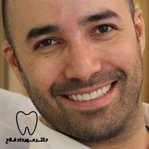 چگونگی اصلاح طرح لبخند